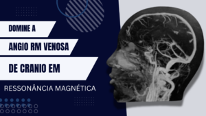 Angioressonância Venosa de crânio