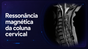 Ressonância Magnética da Coluna Cervical