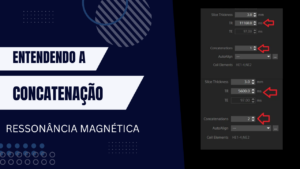 Concatenação MRI