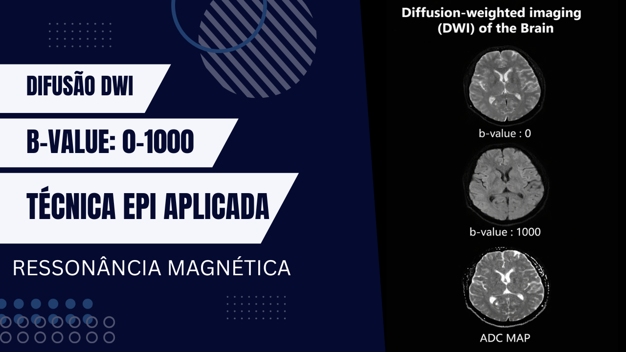 Difusão (DWI)/EPI DWI