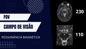 FOV (Campo de visão)