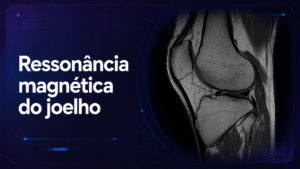 Ressonância Magnética do Joelho