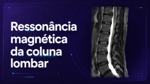 Ressonância Magnética da Coluna Lombar