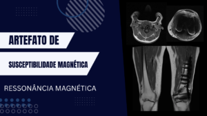 Artefato de Susceptibilidade Magnética