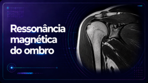 Ressonância Magnética do Ombro