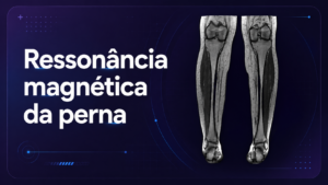 Ressonância Magnética da Perna