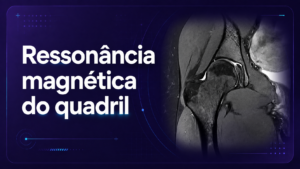 Ressonância Magnética do Quadril