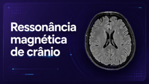 Ressonancia Magnética do crânio