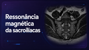 Ressonância Magnética das Sacroilíacas
