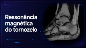 Ressonância Magnética do Tornozelo